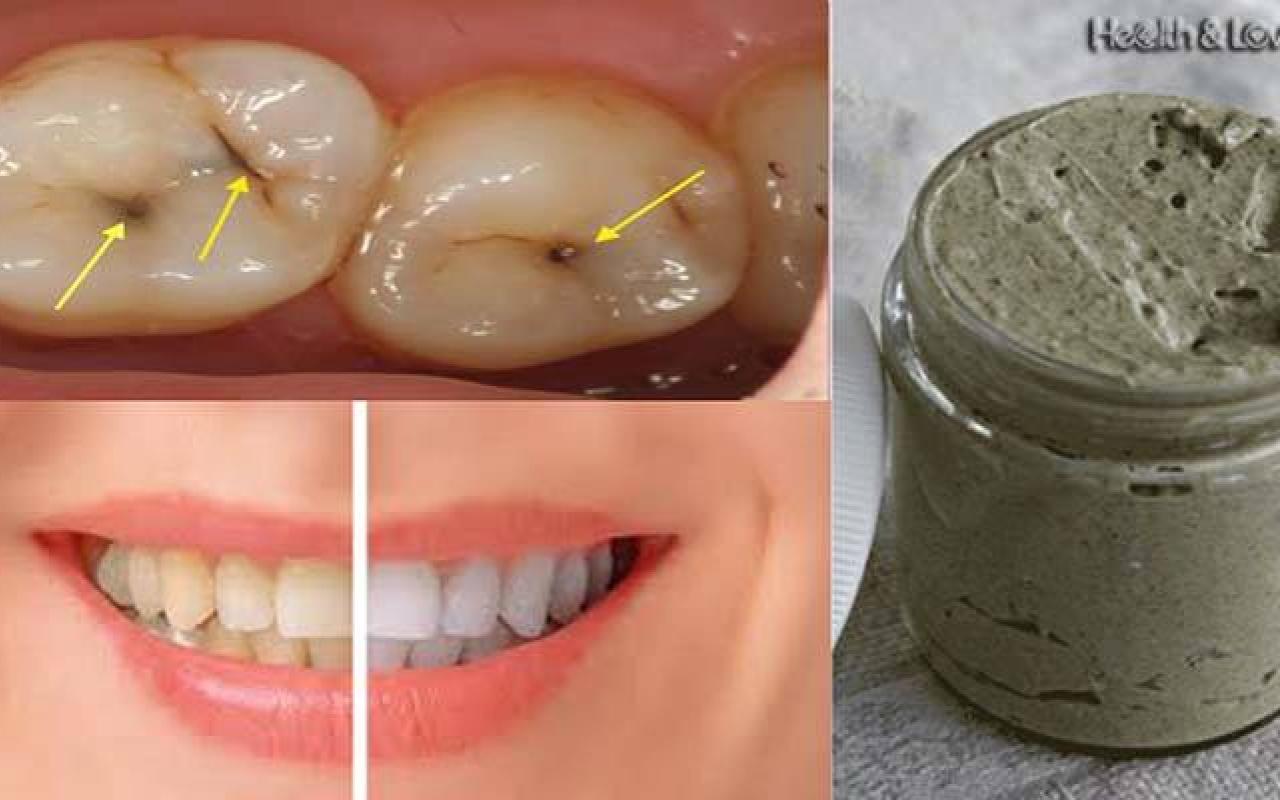 heal-cavities-gum-disease-and-whiten-teeth-with-this-natural-homemade-toothpaste.jpg