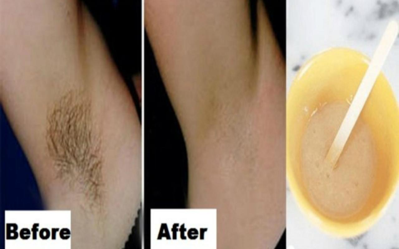 you-only-need-2-ingredients-and-2-minutes-to-get-rid-of-underarm-hair-forever.jpg