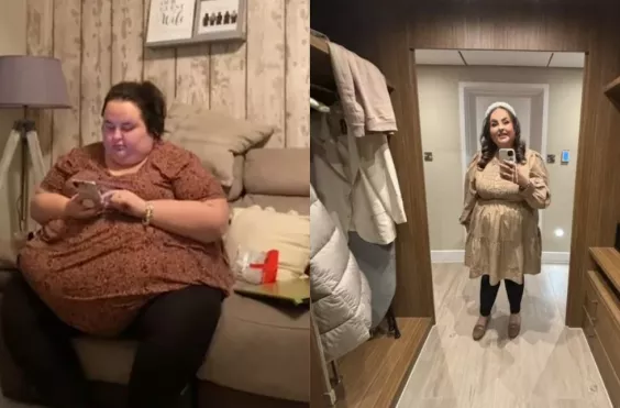 παχυσαρκία γυναίκα πριν μετά