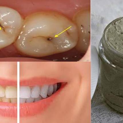 heal-cavities-gum-disease-and-whiten-teeth-with-this-natural-homemade-toothpaste.jpg