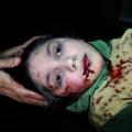 Η 11χρονη από τη Συρία με το βλέμμα στο κενό