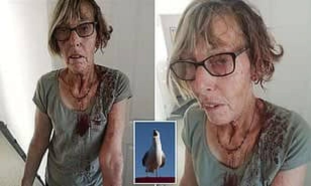 Επίθεση... γλάρου τραυμάτισε 66χρονη γυναίκα στην Αγγλία