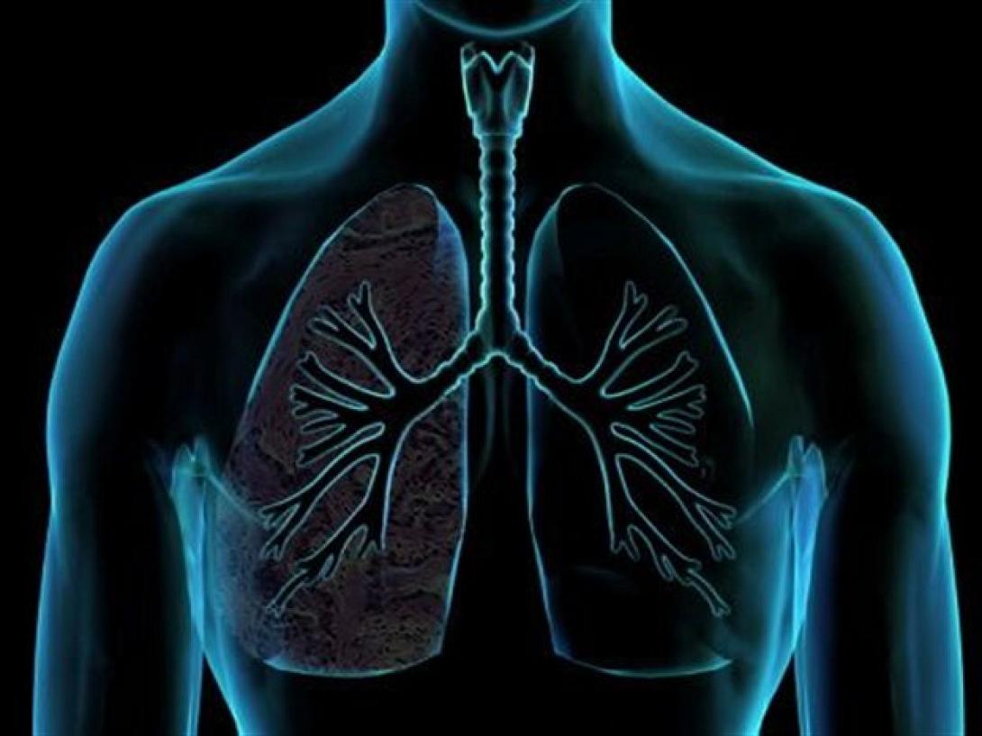 Ο καρκίνος του πνεύμονα μπορεί να παραμείνει κρυμμένος πάνω από 20 χρόνια