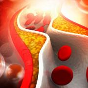 χοληστερίνη