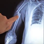 Ακτινογραφία (φωτογραφία από create.vista.com)