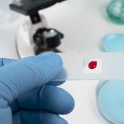 αιματολογική εξέταση