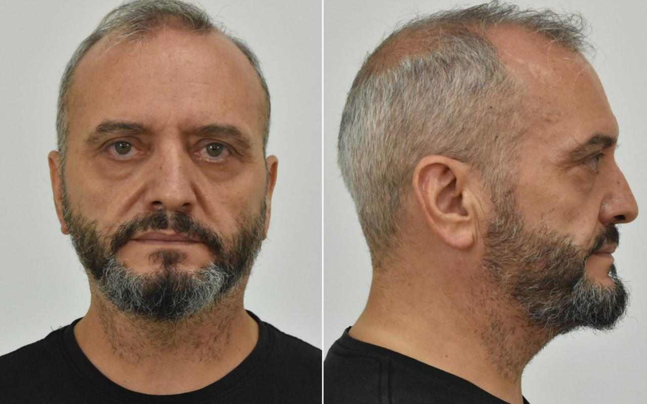 Ηλίας Μίχος