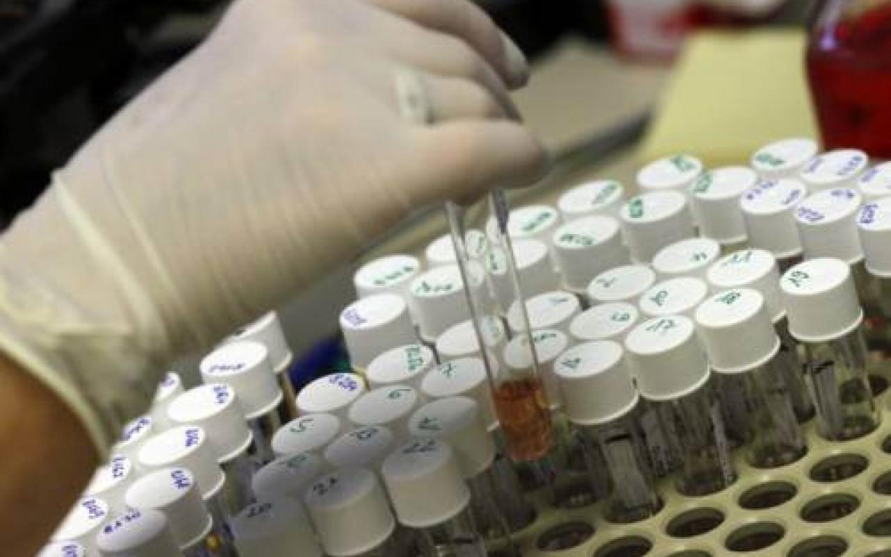Φιαλίδια με ιό της ευλογιάς ανακαλύφθηκαν σε εργαστήριο της Ουάσινγκτον