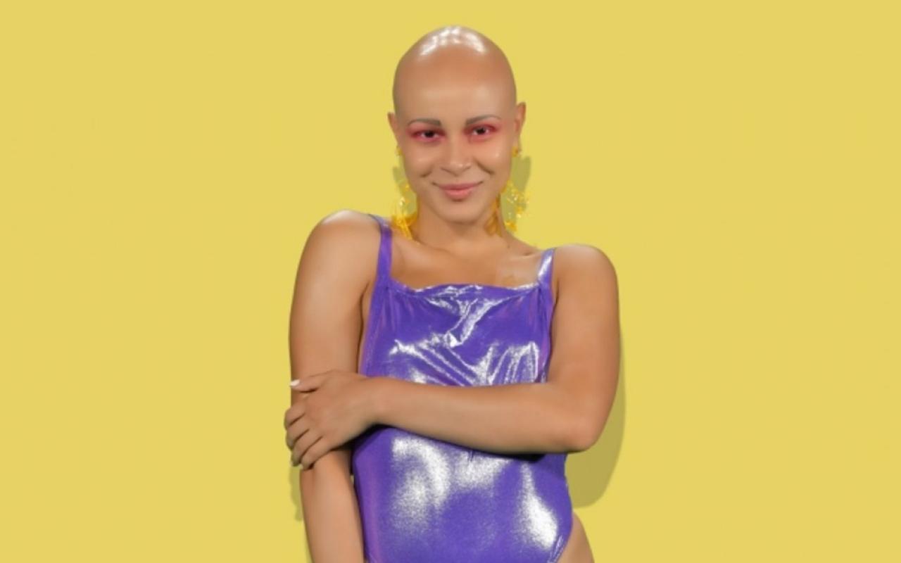 gntm-katsanikaki-alopekia.jpg