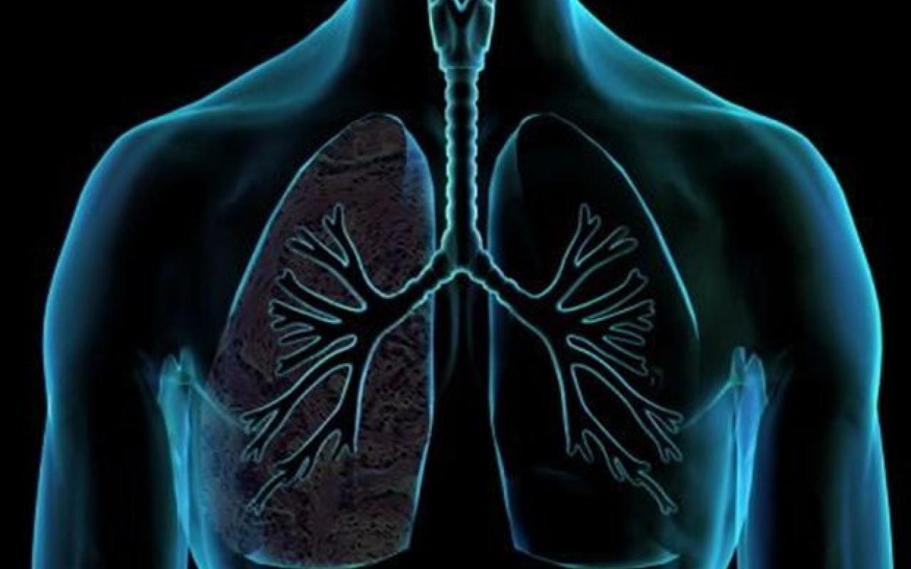 Ο καρκίνος του πνεύμονα μπορεί να παραμείνει κρυμμένος πάνω από 20 χρόνια