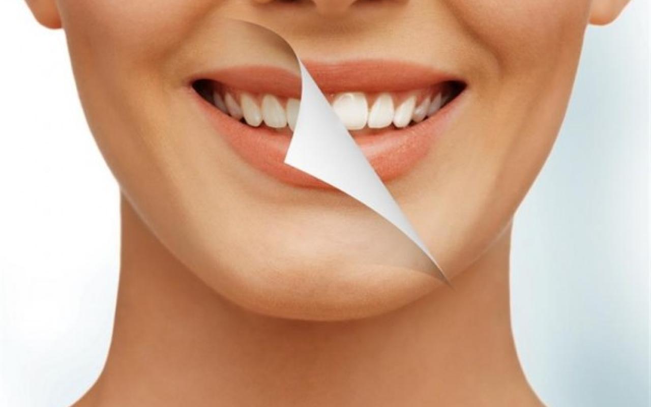Φυσικοί τρόποι για πιο λευκά δόντια!