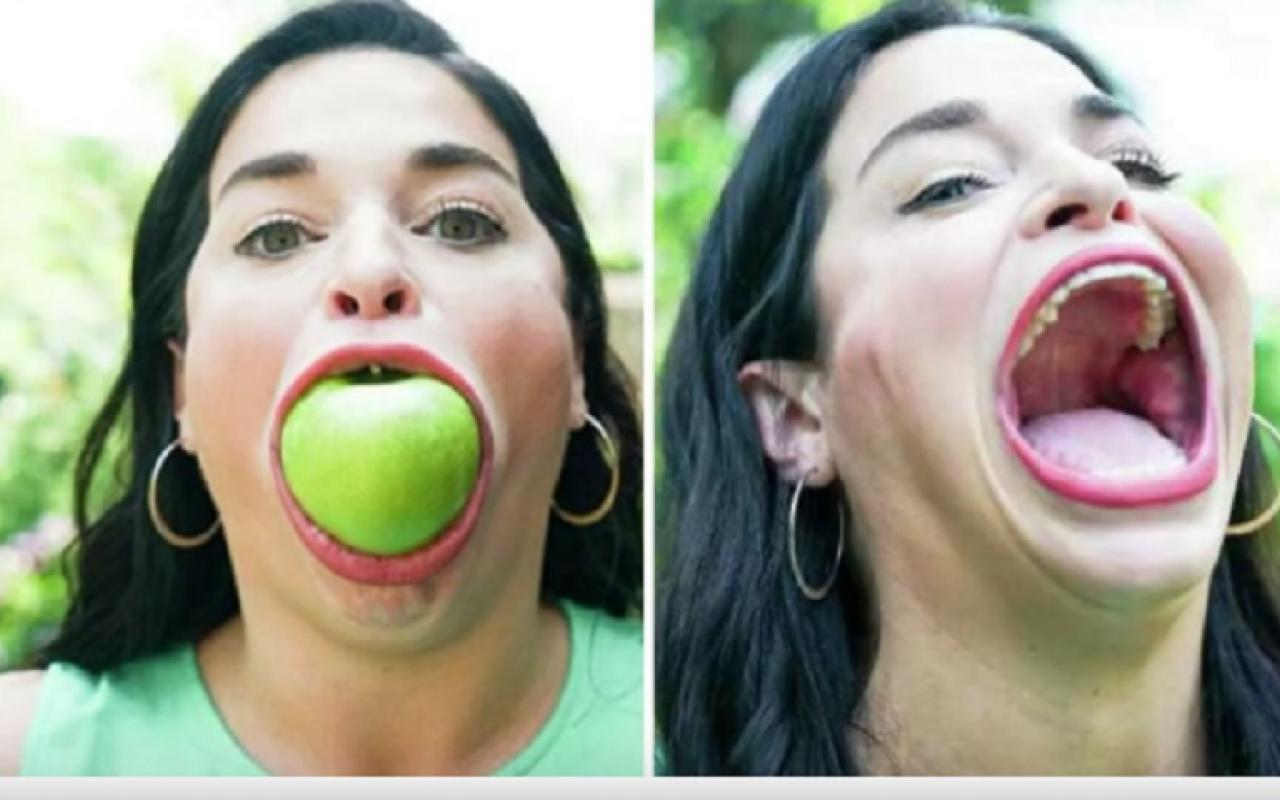Η γυναίκα με το μεγαλύτερο στόμα στον κόσμο