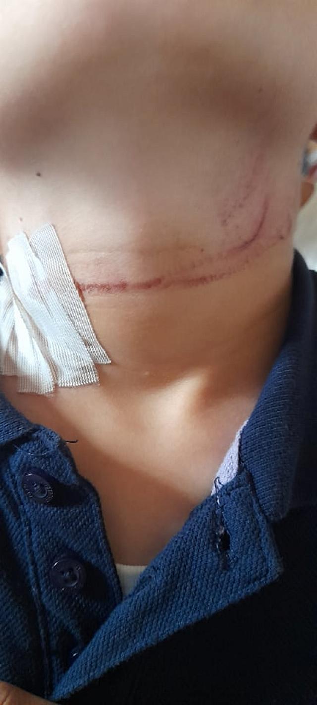 παιδί σκύλος