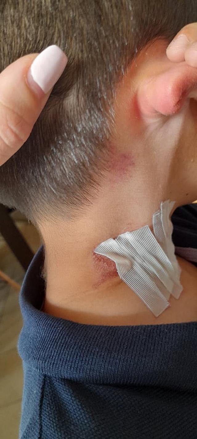 παιδί σκύλος