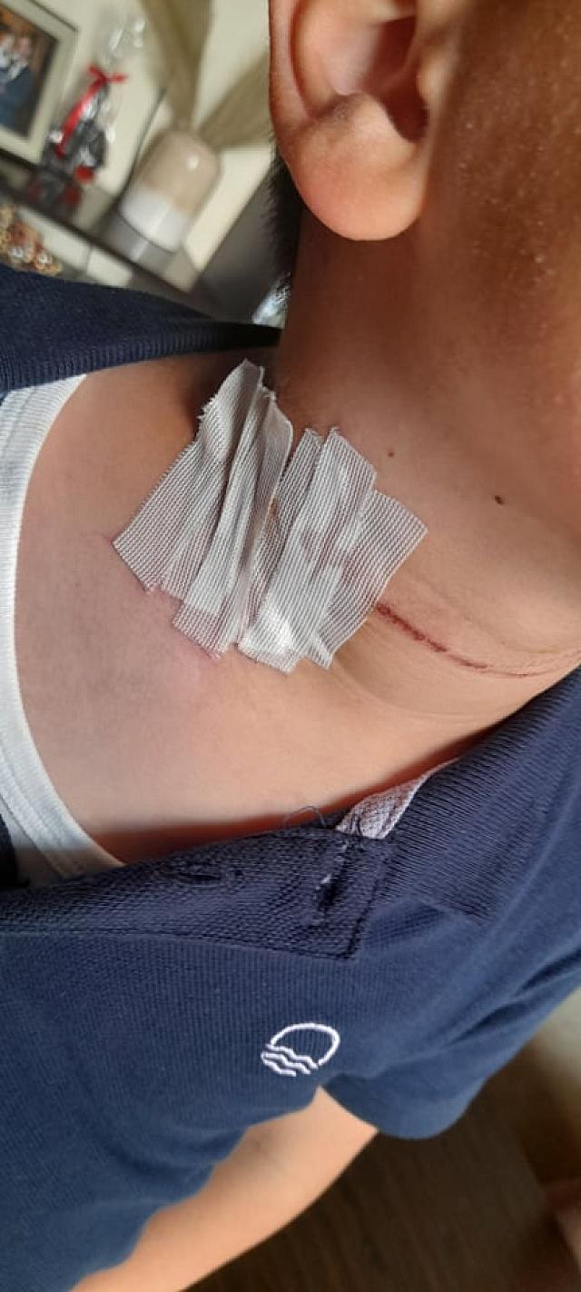 παιδί σκύλος