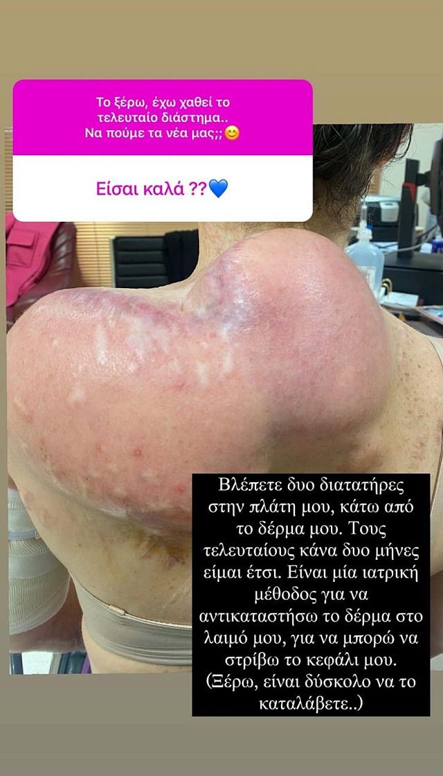 ιωαννα