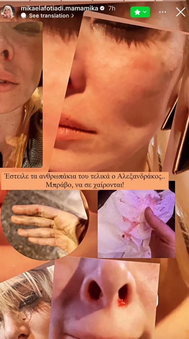 φωτειαδη
