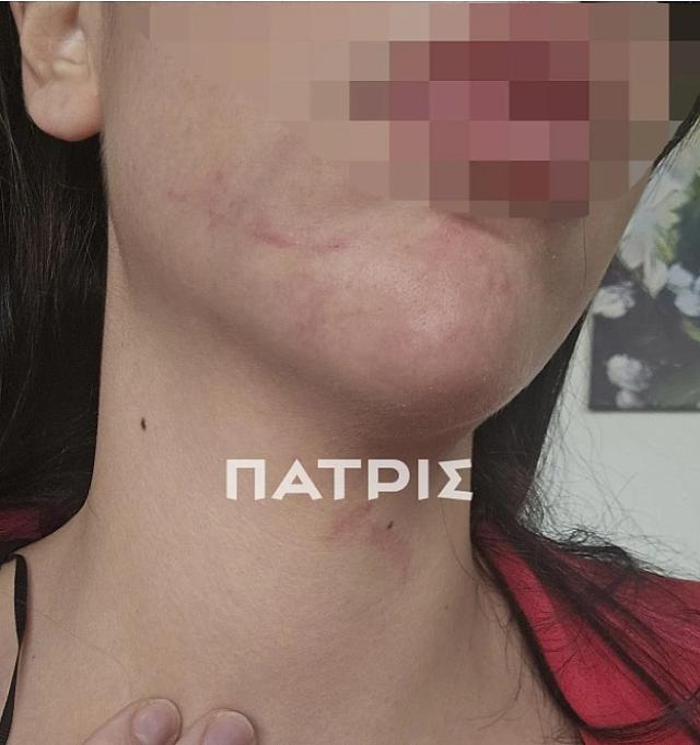 ξυλοδαρμός