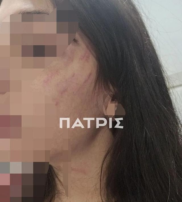 ξυλοδαρμός
