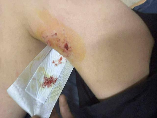 επιθεση σκυλου