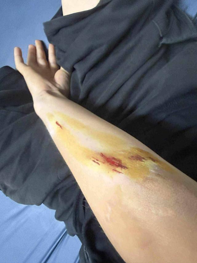 επιθεση σκυλου