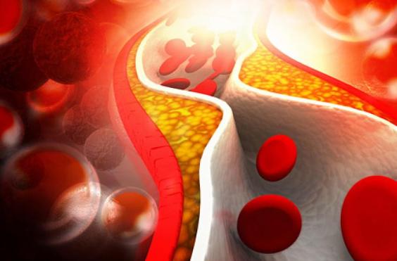 χοληστερίνη