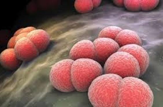 μηνιγγίτιδα