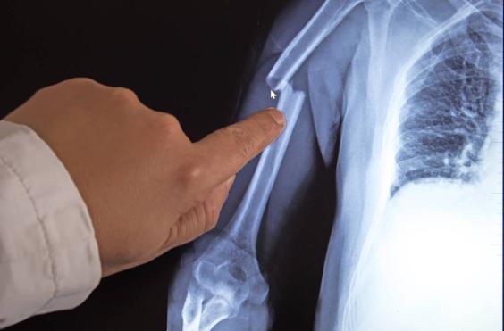 Ακτινογραφία (φωτογραφία από create.vista.com)