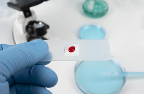 αιματολογική εξέταση