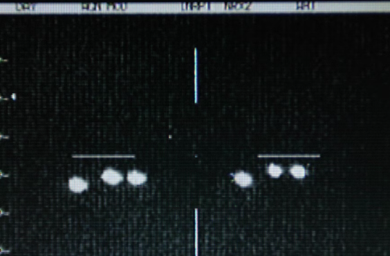 UFO