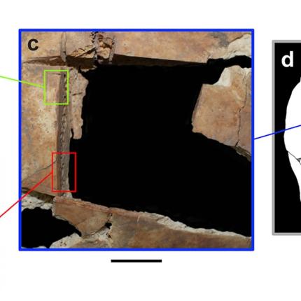 χειρουργείο εγκέφαλος