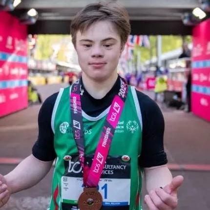 19ΧΡΟΝΟΣ σύνδρομο Down