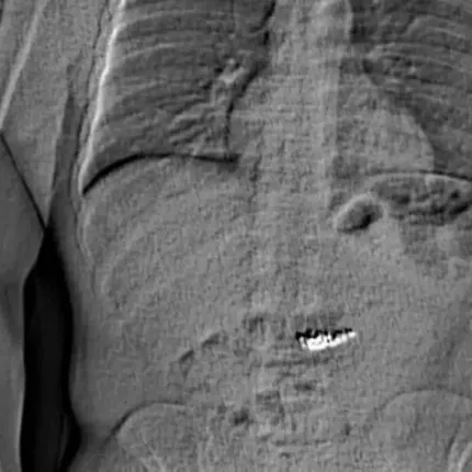 σκουλαρικια 