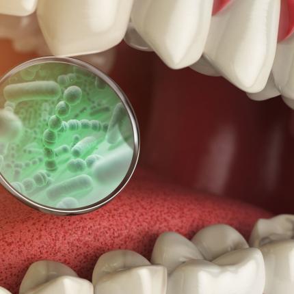 καρκίνος παγκρέατος στοματική υγεία