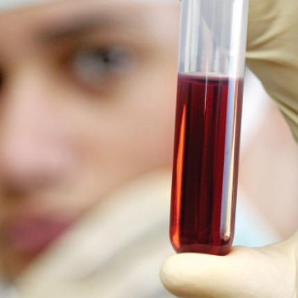 Πρωτοποριακό τεστ αίματος υπολογίζει το χρόνο ανάρρωσης από εγχείρηση 