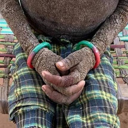 κοριτσάκι στην Ινδία