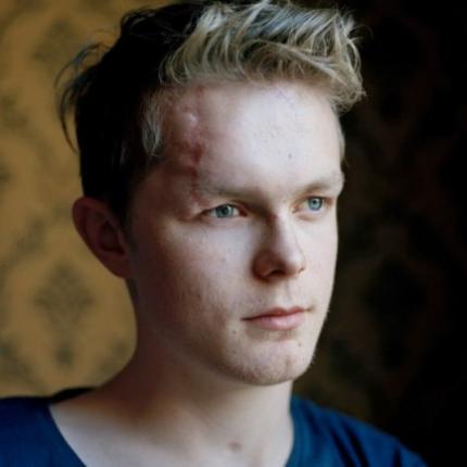 Οι επιζώντες από τις σφαίρες του Μπρέιβικ τρία χρόνια μετά 