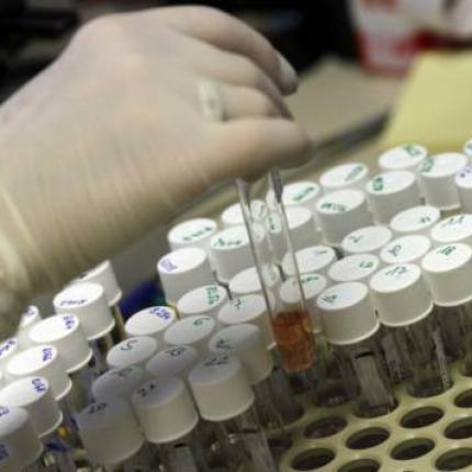 Φιαλίδια με ιό της ευλογιάς ανακαλύφθηκαν σε εργαστήριο της Ουάσινγκτον