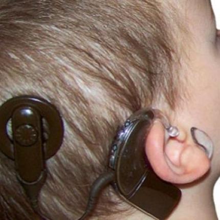 κοχλιακό εμφύτευμα