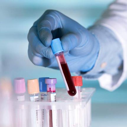 τεστ αίματος