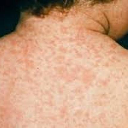 arheio_lipsis.jpg
