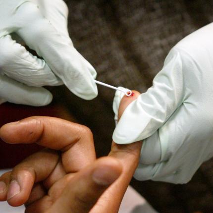 Επανεμφανίστηκε ο ιός HIV και στο δεύτερο παιδί που είχε «θεραπευτεί»