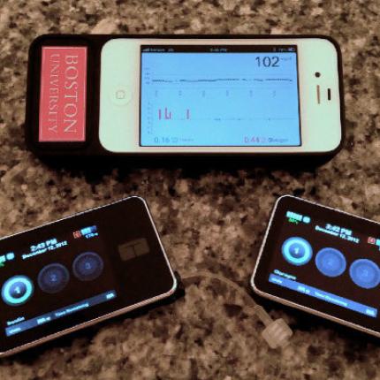 Φορητό βιονικό πάγκρεας για τους ασθενείς με διαβήτη