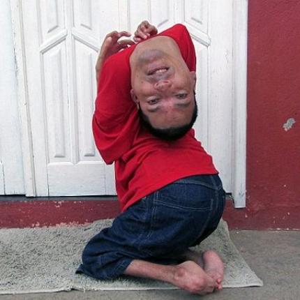 Γεννήθηκε με το κεφάλι ... ανάποδα (φωτογραφίες)