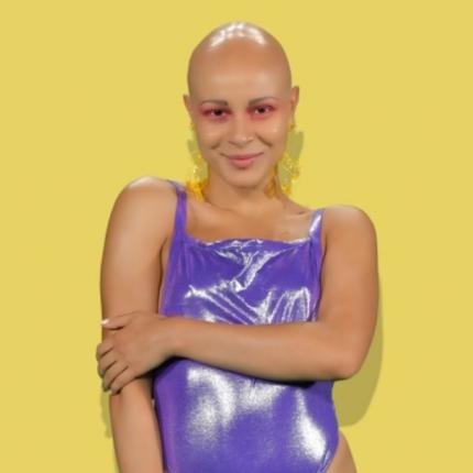 gntm-katsanikaki-alopekia.jpg