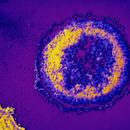 Νέα ανακάλυψη: Κατασκευασμένα κύτταρα «μπλοκάρουν» τον ιό HIV