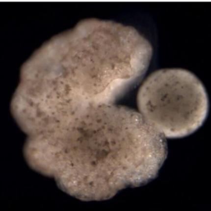 ΖΩΝΤΑΝΑ ΡΟΜΠΟΤ