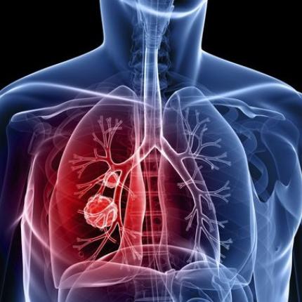 Οι πιο συχνοί τύποι καρκίνου στους Έλληνες