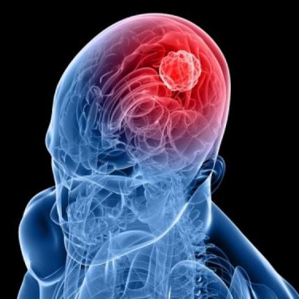 καρκίνος εγκεφάλου