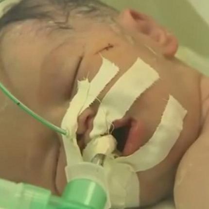 Κοριτσάκι ήρθε στη ζωή ενώ η μητέρα του "έφευγε" - Συγκλονιστικό βίντεο από τη Γάζα